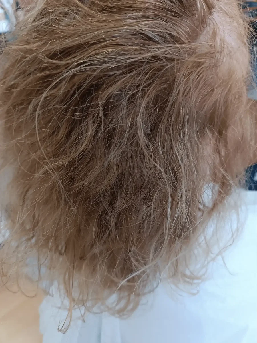 Cabello antes del tratamiento